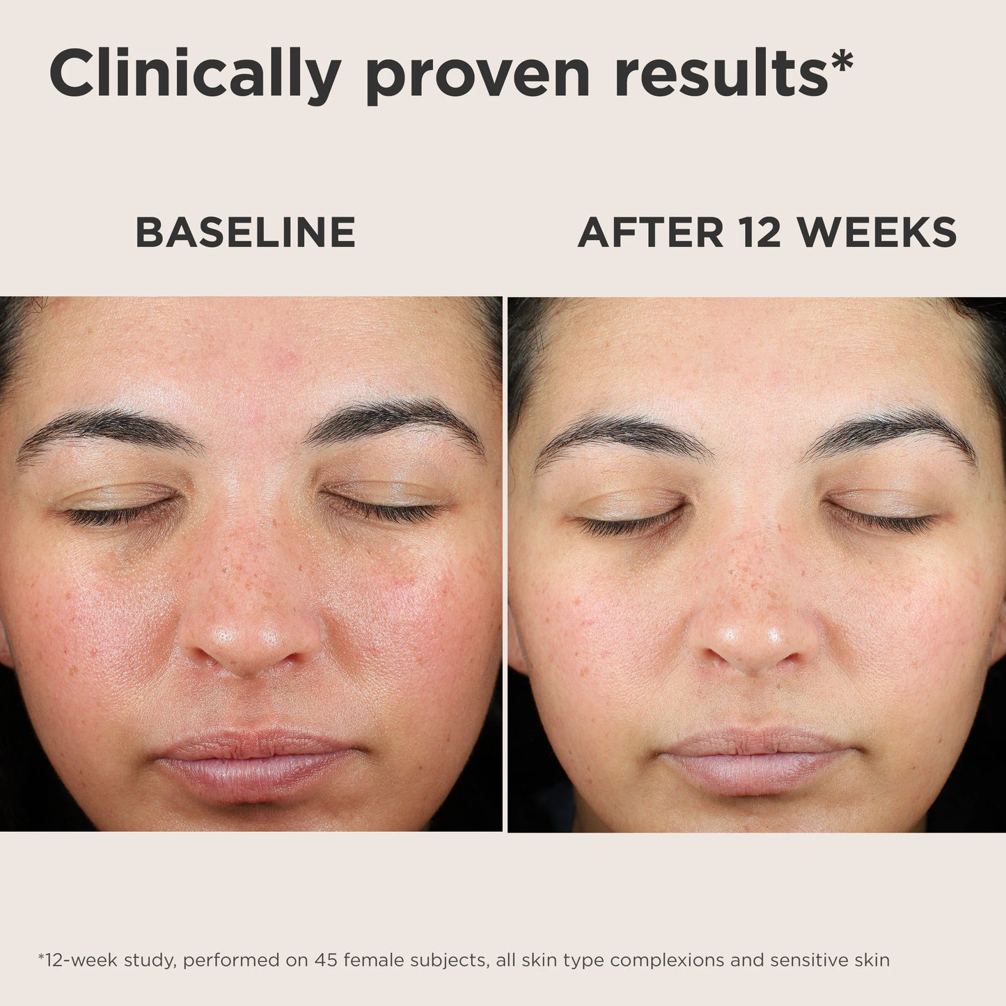 EltaMD UV Skin Recovery Red Color Correcting Green Tint Broad Spectrum SPF 50