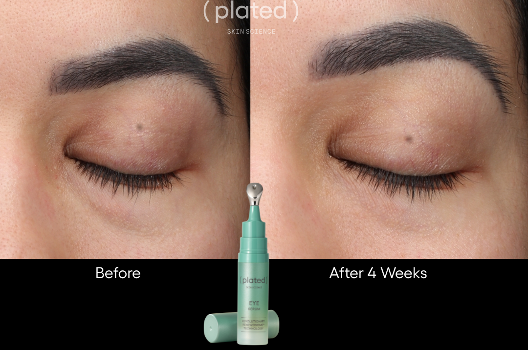 Plated EYE