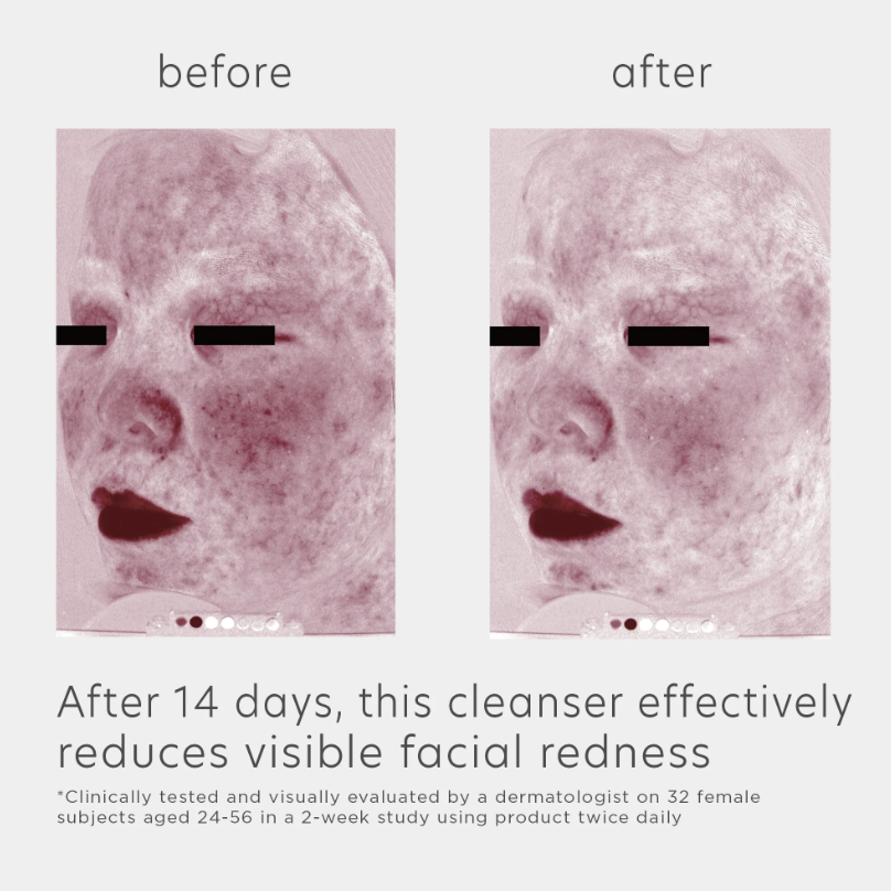 EltaMD Skin Recovery Essence Toner
