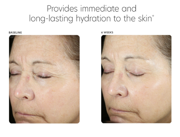 PCA Hyaluronic Acid Boosting Serum