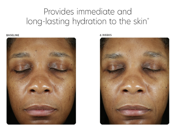 PCA Hyaluronic Acid Boosting Serum