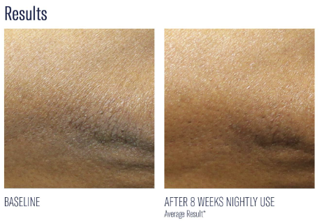 Skinbetter AlphaRet Body Overnight Cream