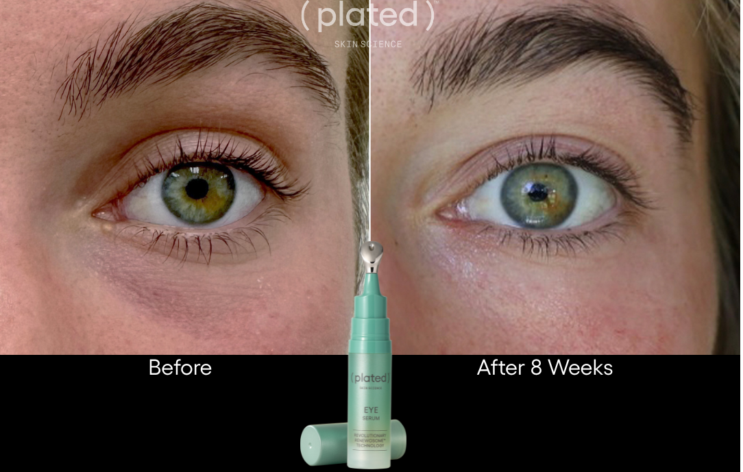 Plated EYE