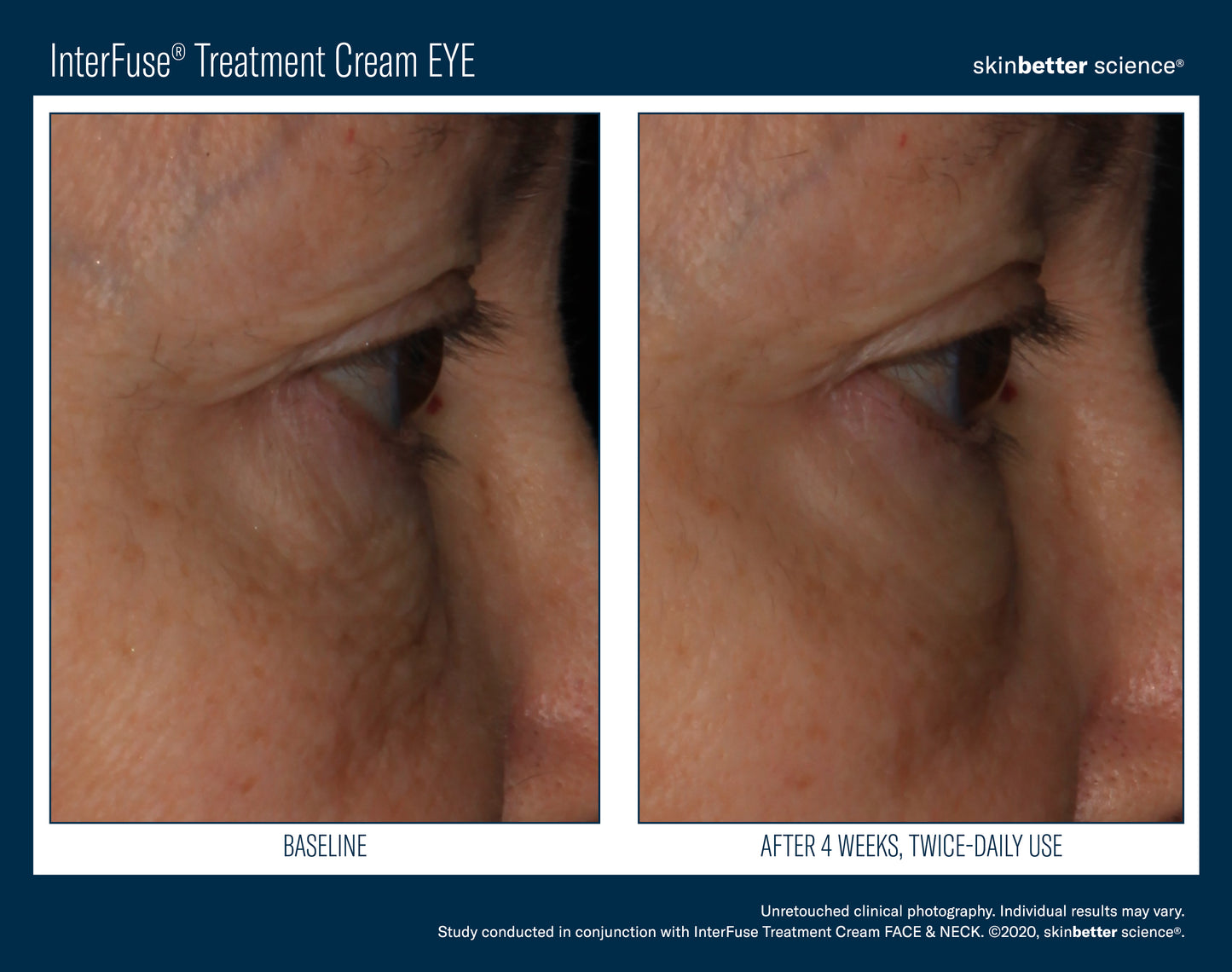 Skinbetter Interfuse Treatment Cream EYE