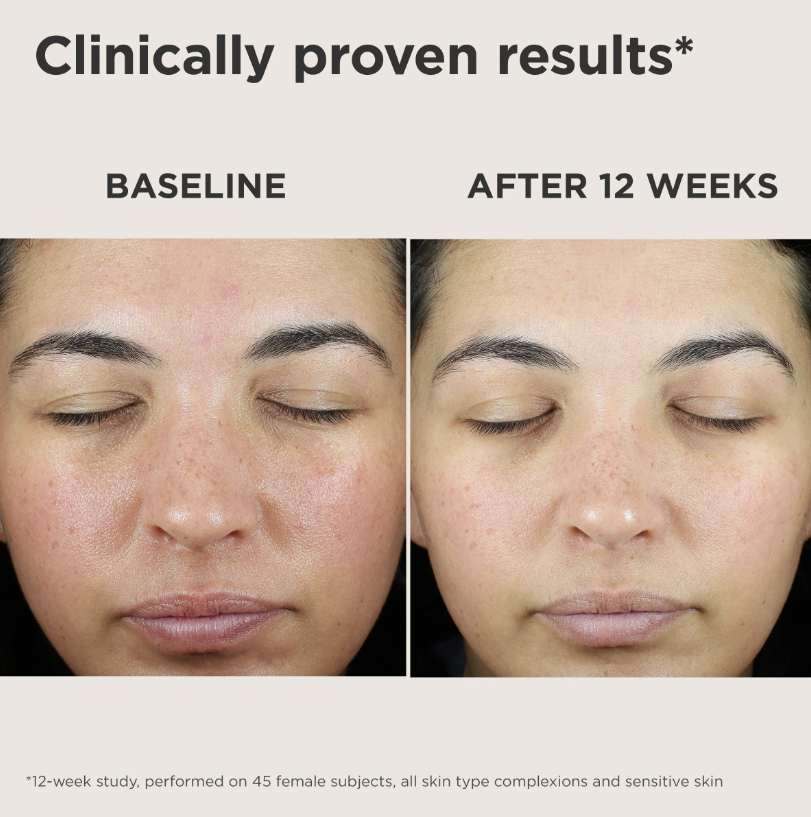 EltaMD UV Skin Recovery Broad Spectrum SPF 50 Face Sunscreen